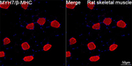MYH7 Antibody in Immunohistochemistry (Paraffin) (IHC (P))