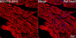 MYH7 Antibody in Immunohistochemistry (Paraffin) (IHC (P))