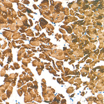 MYH7 Antibody in Immunohistochemistry (Paraffin) (IHC (P))