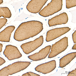 MYH7 Antibody in Immunohistochemistry (Paraffin) (IHC (P))