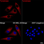 Tyrosinase Recombinant Rabbit Monoclonal Antibody (5V0H6)