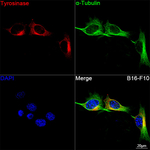 Tyrosinase Antibody in Immunocytochemistry (ICC/IF)