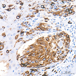 Tyrosinase Antibody in Immunohistochemistry (Paraffin) (IHC (P))