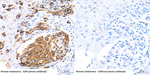 Tyrosinase Antibody in Immunohistochemistry (Paraffin) (IHC (P))