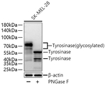 Tyrosinase Antibody in Western Blot (WB)