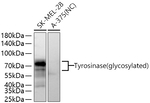 Tyrosinase Antibody in Western Blot (WB)