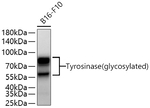 Tyrosinase Antibody in Western Blot (WB)