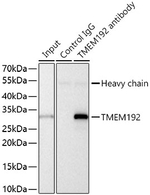 TMEM192 Antibody in Immunoprecipitation (IP)