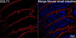 SGLT1 Recombinant Rabbit Monoclonal Antibody (1C5W2)