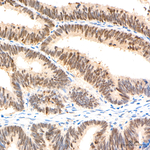 FOXO3A Recombinant Rabbit Monoclonal Antibody (7D7H1)