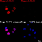 Phospho-Cofilin (Ser3) Recombinant Rabbit Monoclonal Antibody (7G1H6)