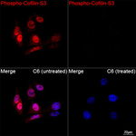 Phospho-Cofilin (Ser3) Antibody in Immunocytochemistry (ICC/IF)
