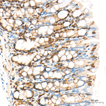 Phospho-Cofilin (Ser3) Antibody in Immunohistochemistry (Paraffin) (IHC (P))