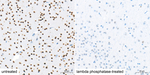 Phospho-Cofilin (Ser3) Antibody in Immunohistochemistry (Paraffin) (IHC (P))
