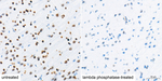 Phospho-Cofilin (Ser3) Antibody in Immunohistochemistry (Paraffin) (IHC (P))