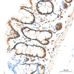 Phospho-Cofilin (Ser3) Antibody in Immunohistochemistry (Paraffin) (IHC (P))