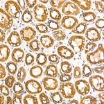 PDI Antibody in Immunohistochemistry (Paraffin) (IHC (P))