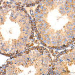 PDI Antibody in Immunohistochemistry (Paraffin) (IHC (P))