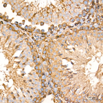 PDI Antibody in Immunohistochemistry (Paraffin) (IHC (P))