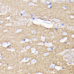 CD56 Recombinant Rabbit Monoclonal Antibody (6I1U5)