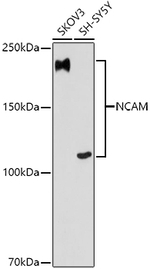 CD56 Antibody in Western Blot (WB)