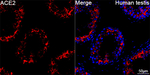 ACE2 Recombinant Rabbit Monoclonal Antibody (2D6W1)