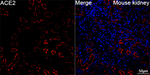 ACE2 Antibody in Immunohistochemistry (Paraffin) (IHC (P))