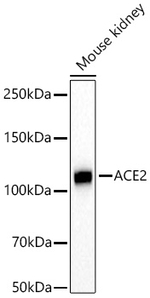 ACE2 Antibody in Western Blot (WB)