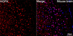 HOPX Antibody in Immunohistochemistry (Paraffin) (IHC (P))