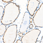 HOPX Antibody in Immunohistochemistry (Paraffin) (IHC (P))