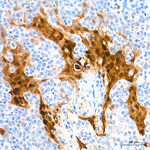 HOPX Antibody in Immunohistochemistry (Paraffin) (IHC (P))