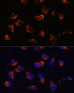 CA19-9 Recombinant Mouse Monoclonal Antibody (8S4C1)