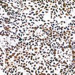 H3K18ac Antibody in Immunohistochemistry (Paraffin) (IHC (P))