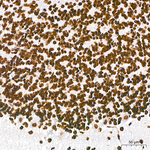 H3K18ac Antibody in Immunohistochemistry (Paraffin) (IHC (P))