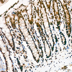 H3K18ac Antibody in Immunohistochemistry (Paraffin) (IHC (P))