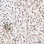 H3K18ac Antibody in Immunohistochemistry (Paraffin) (IHC (P))