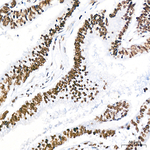 H3K18ac Recombinant Rabbit Monoclonal Antibody (3O10D2)