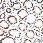 H3K18ac Antibody in Immunohistochemistry (Paraffin) (IHC (P))