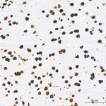 H3K18ac Antibody in Immunohistochemistry (Paraffin) (IHC (P))