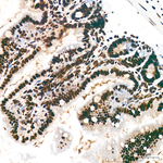 H3K18ac Antibody in Immunohistochemistry (Paraffin) (IHC (P))