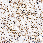 H3K18ac Antibody in Immunohistochemistry (Paraffin) (IHC (P))
