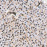 H3K18ac Antibody in Immunohistochemistry (Paraffin) (IHC (P))