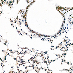 H3K18ac Antibody in Immunohistochemistry (Paraffin) (IHC (P))
