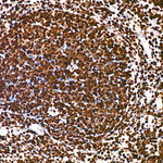 H3K18ac Antibody in Immunohistochemistry (Paraffin) (IHC (P))