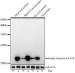 H3K18ac Antibody in Western Blot (WB)