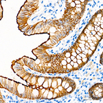 Villin Antibody in Immunohistochemistry (Paraffin) (IHC (P))
