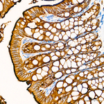 Villin Antibody in Immunohistochemistry (Paraffin) (IHC (P))