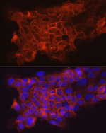 CD141 Antibody in Immunocytochemistry (ICC/IF)