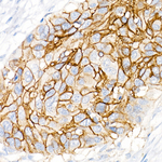 CD141 Antibody in Immunohistochemistry (Paraffin) (IHC (P))