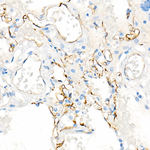 CD141 Antibody in Immunohistochemistry (Paraffin) (IHC (P))